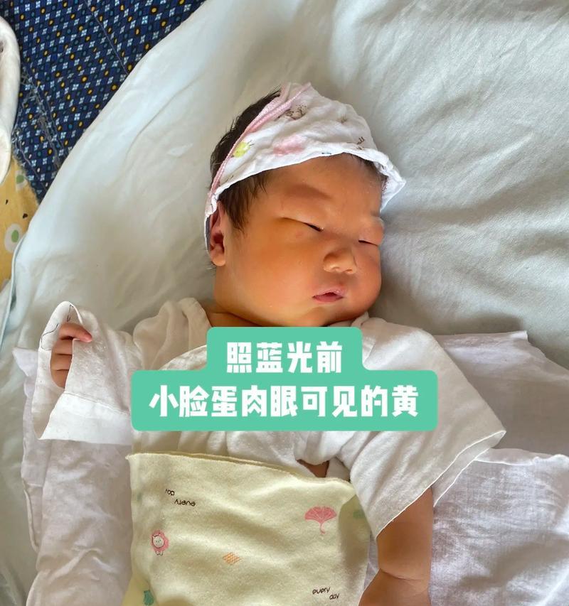 皮皮宝宝在英雄联盟中怎么获得？